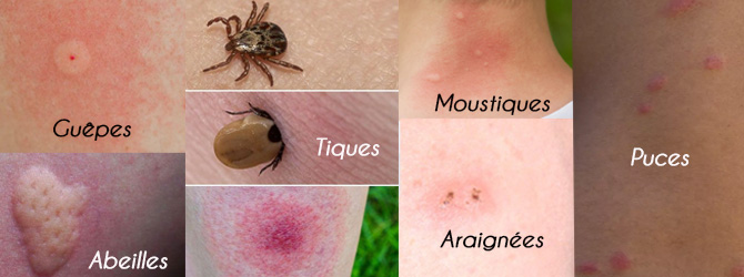 Tous Les Conseils Aromath rapie Pour Les Piqures De Moustiques